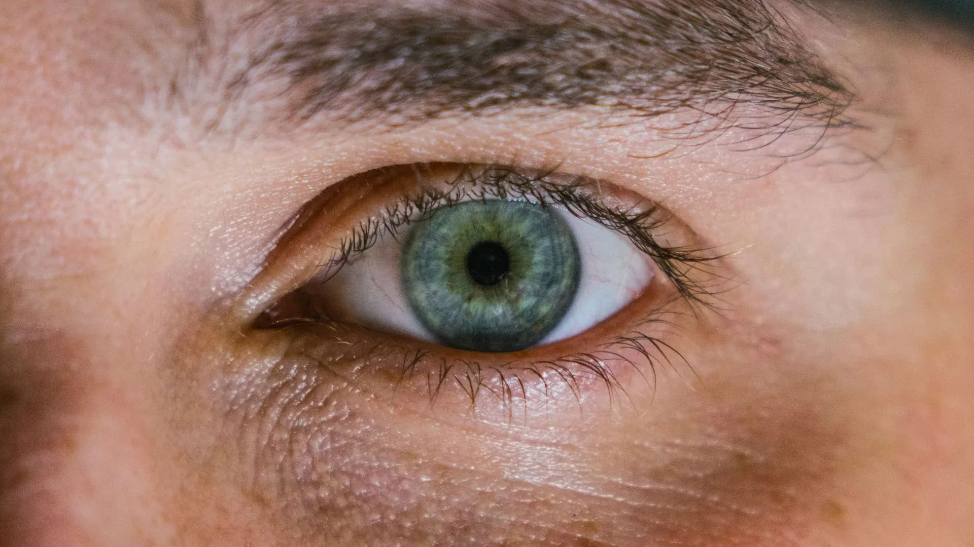 Dry Eye Syndrome: What are some of the causes and what can you do